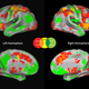 Illustration for article titled Brain Scans Reveal When Your Decisions Are Getting Risky